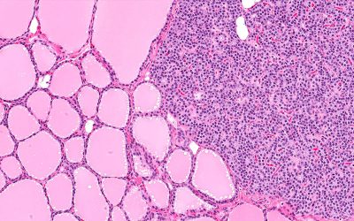 What is Tissue Embedding Wax Used For?